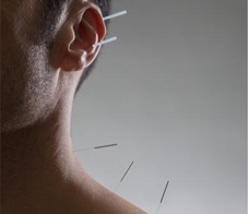 accupuncture-relieve-depression-newsletter