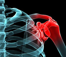 shoulder-injury-teaser_0-NL