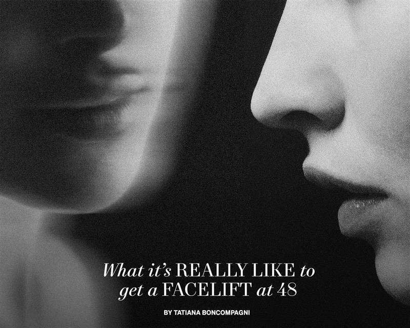 What It's Really Like to Get a Facelift at 48