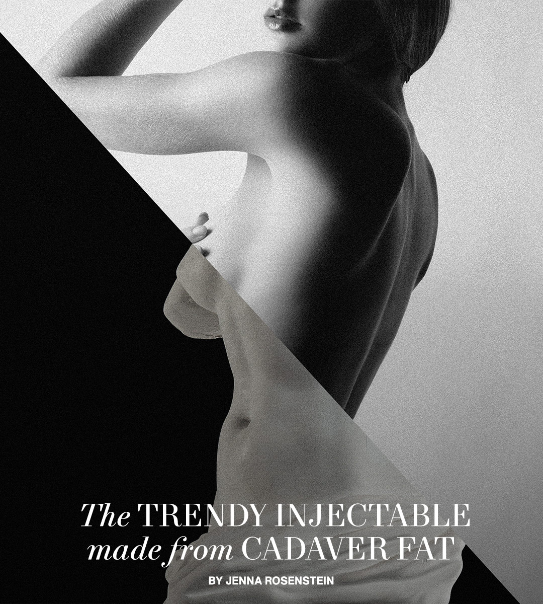 The Trendy Injectable Made From Cadaver Fat