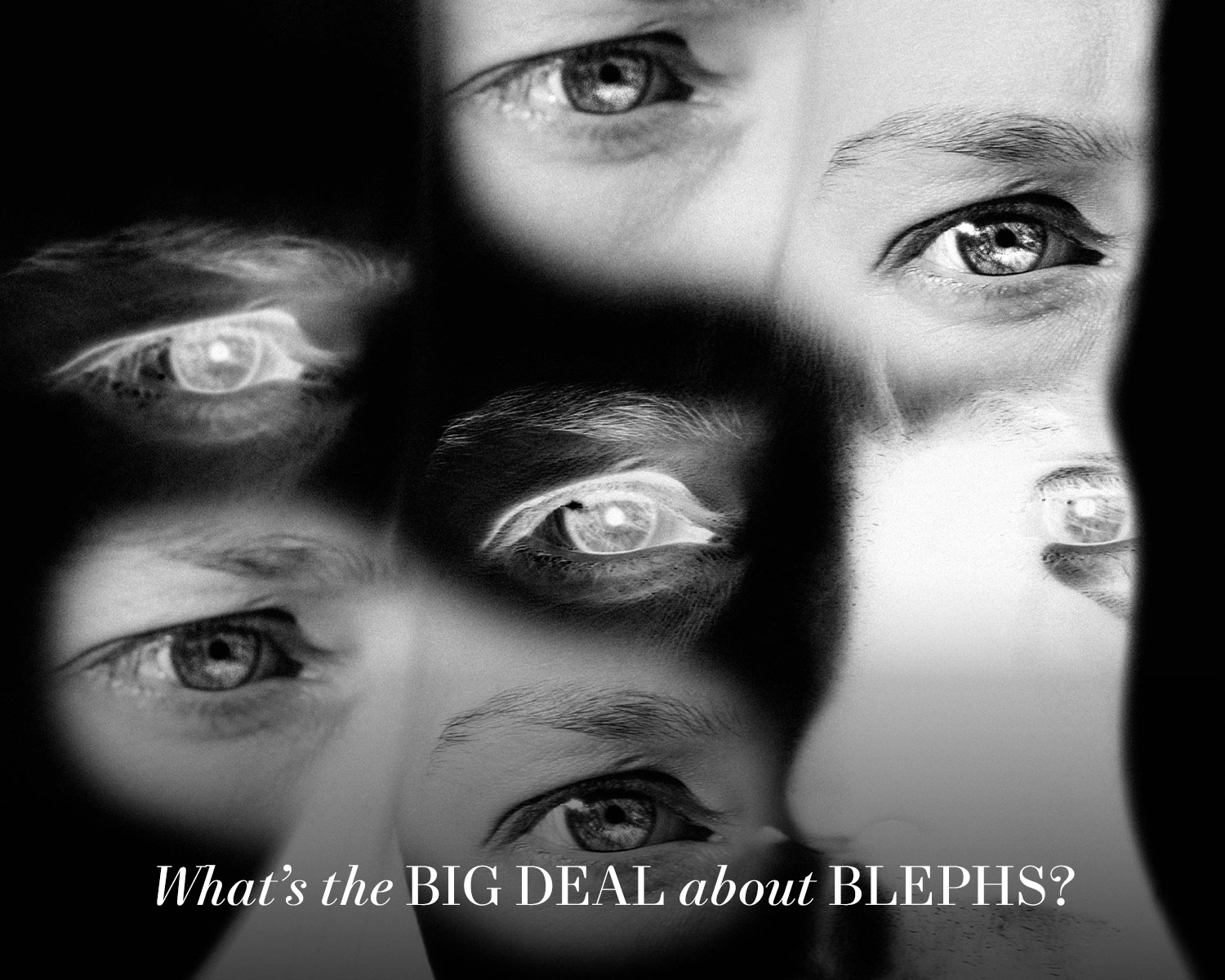 What’s the Big Deal About Blephs?