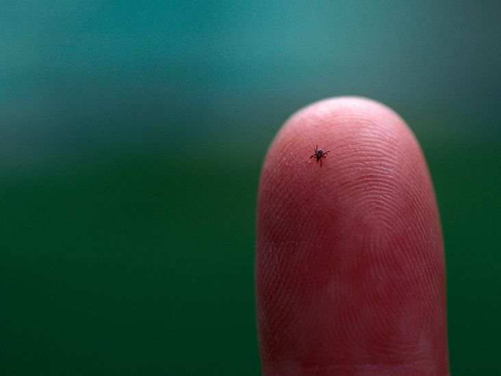 Tick Bites Highest In 5 Years, CDC Says. How to Protect Yourself