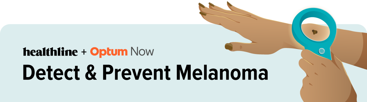 Detecting and Preventing Melanoma