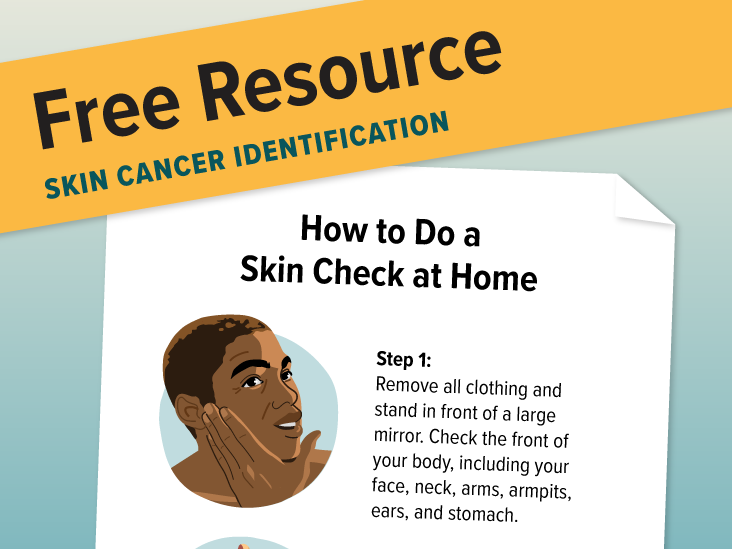How to Identify Skin Cancer with the ABCDE Rule