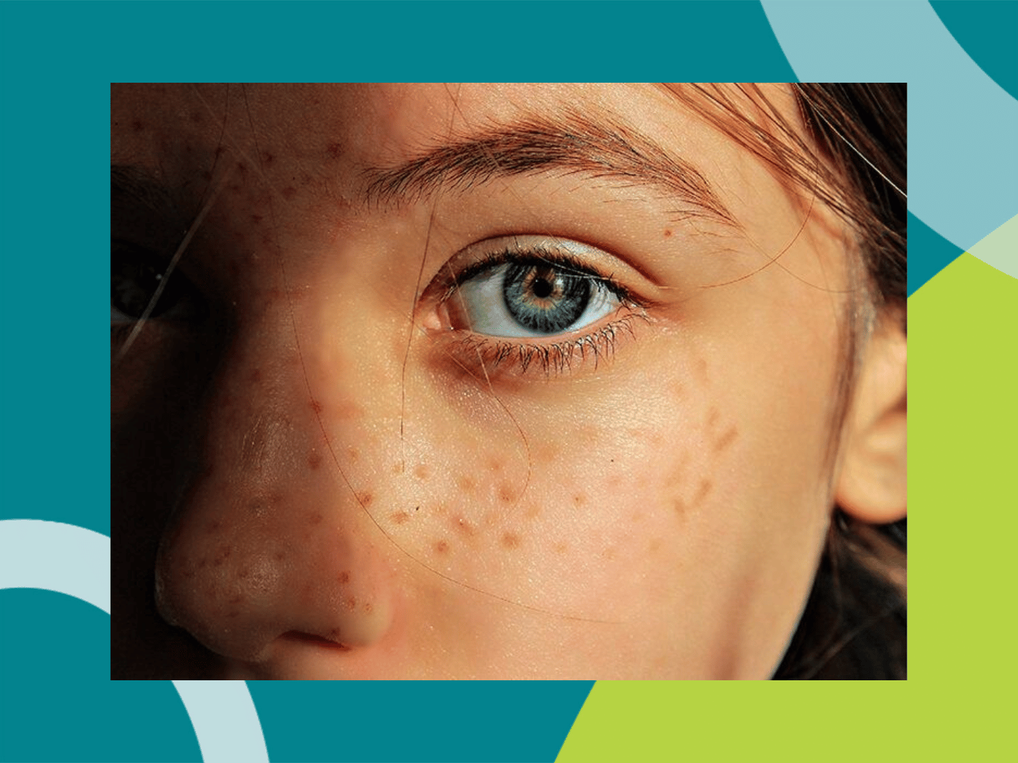 The pigments that protect your sharpest vision