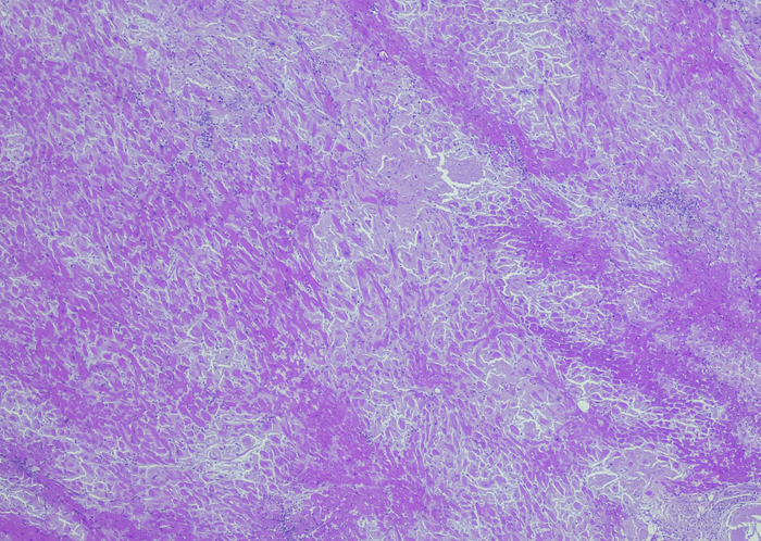 A pink-dyed scan of cell tissue.