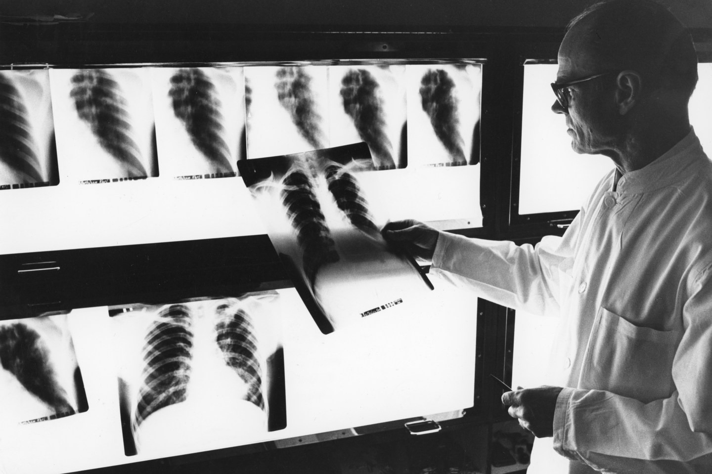 A  black-and-white photo of a doctor examining x-rays.