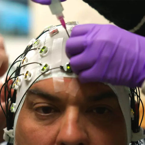 A person has a cap with wires on their head A person has a cap with wires on their head