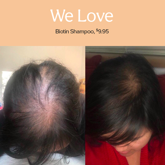 Biotin Shampoo — $9.95