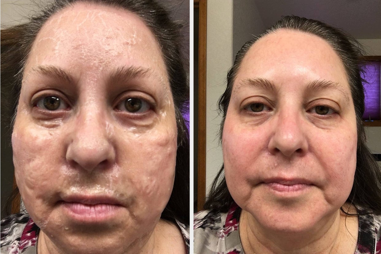 24 Beauty Products With Before And After Photos That Simply Can't Be Ignored