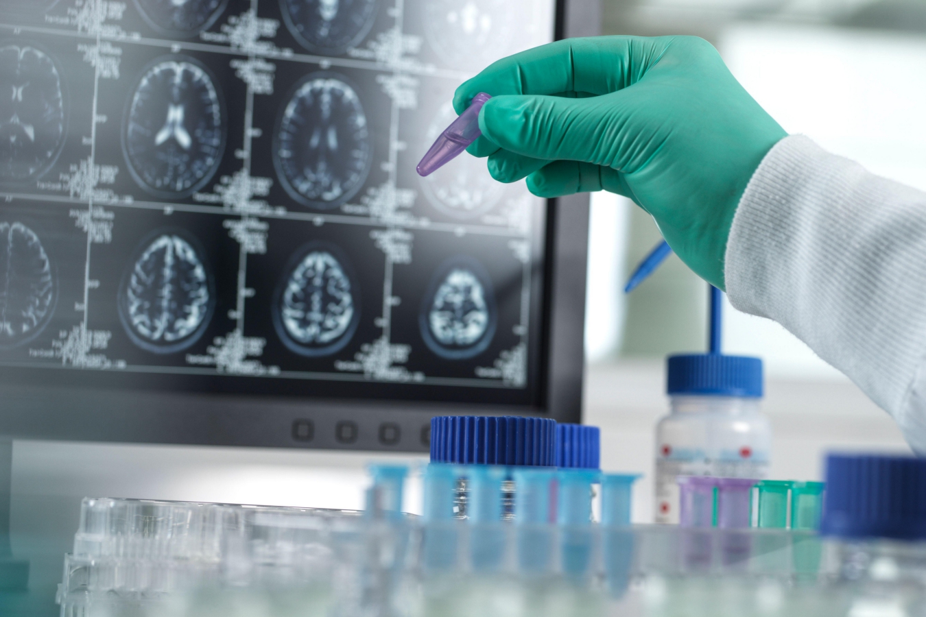 A gloved hand holds a laboratory vial in front of a background of brain scans