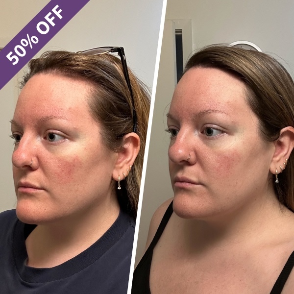 Dr. Brandt Microneedling Recovery Kit