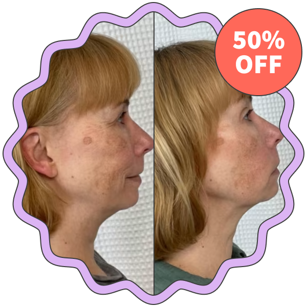SickScience Labs ShapeShift Advanced Jaw & Neck Defining Serum
