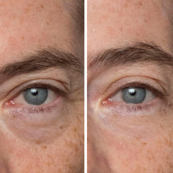 Peter Thomas Roth Instant FIRMx Eye Tightener