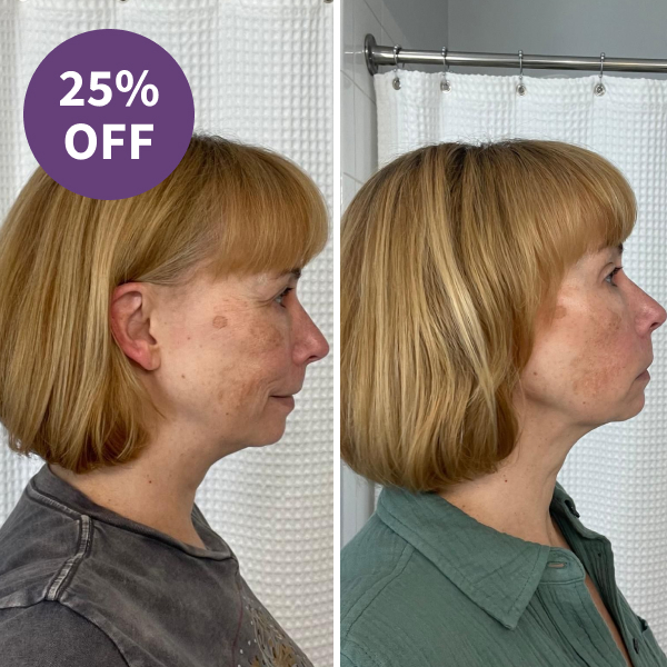 SickScience ShapeShift V-Line Jaw Defining Serum