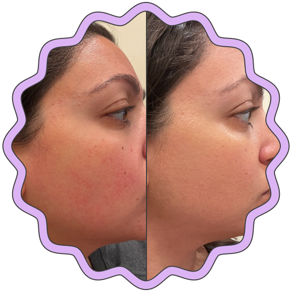 Hero Cosmetics Rescue Balm Color-Correcting Green Cream