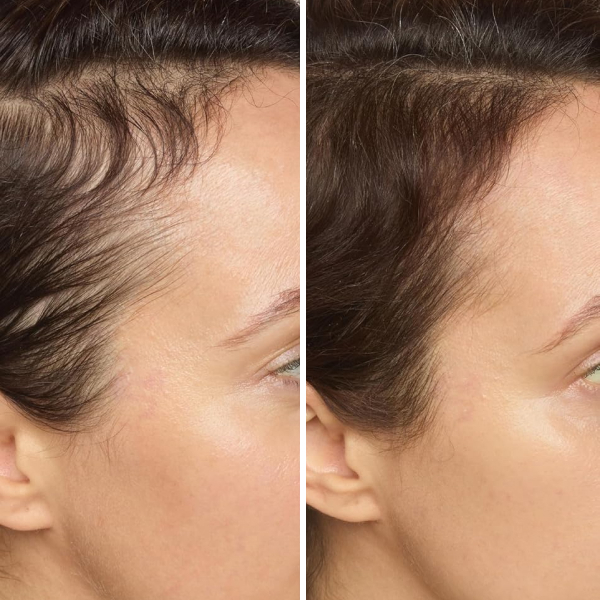 John Frieda ULTRAfiller+ Hair Density Scalp Serum for Fine Hair