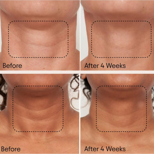 Alpyn Super Sculpt Serum