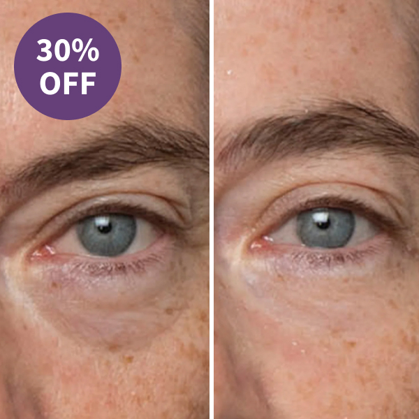 Peter Thomas Roth Instant FIRMx Eye Tightener