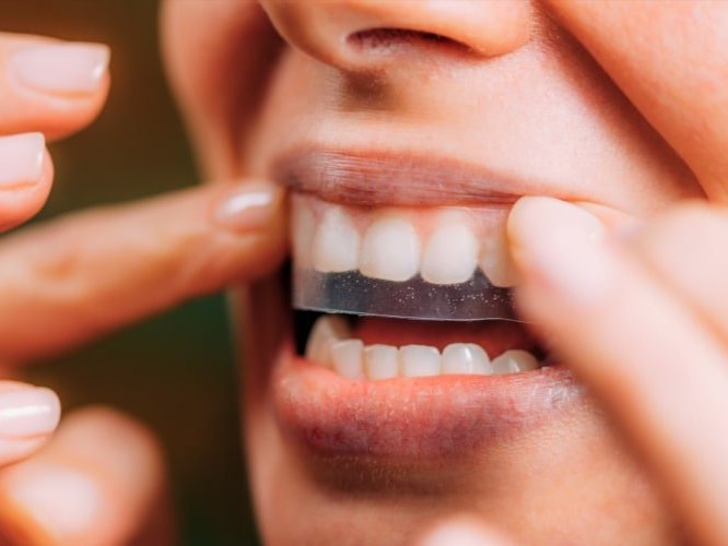 teeth whitening strip