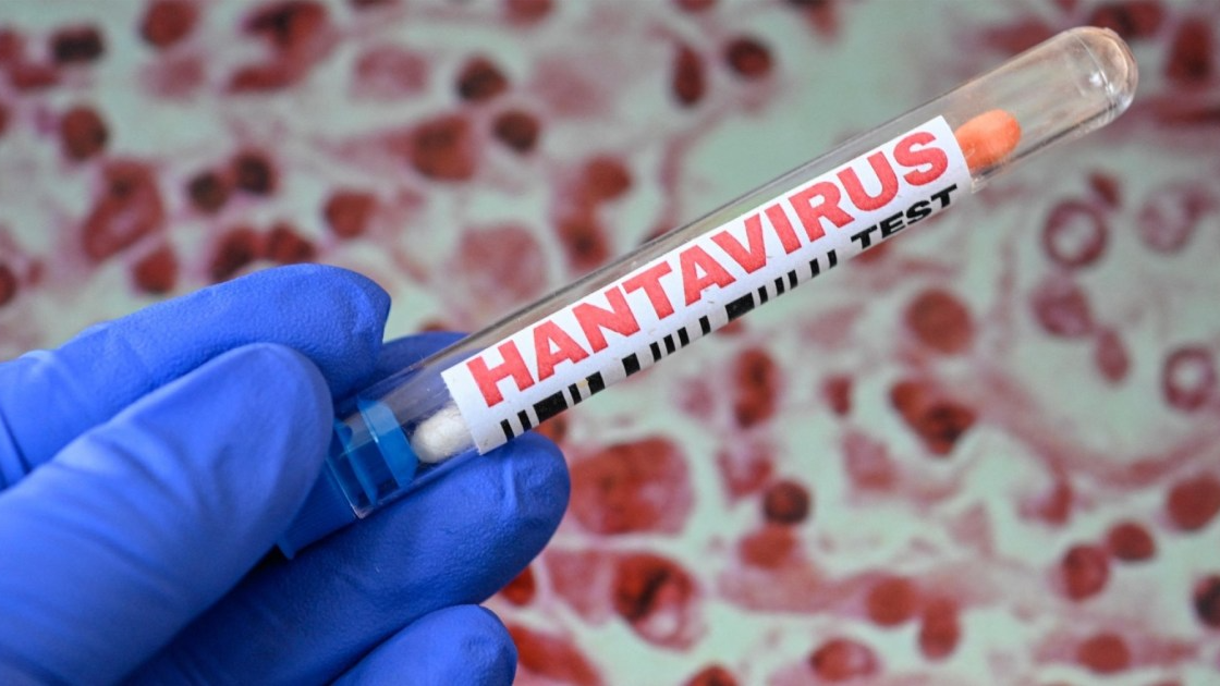 Hantavirus