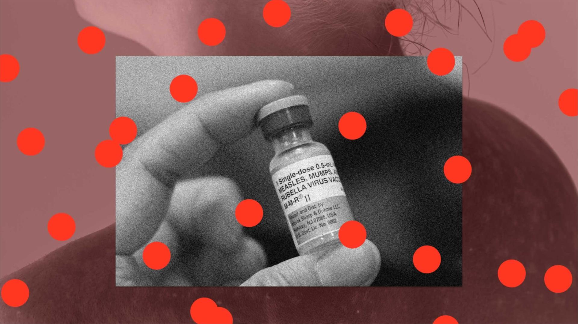 A photo collage showing the measles vaccine overlaying a young woman with the virus