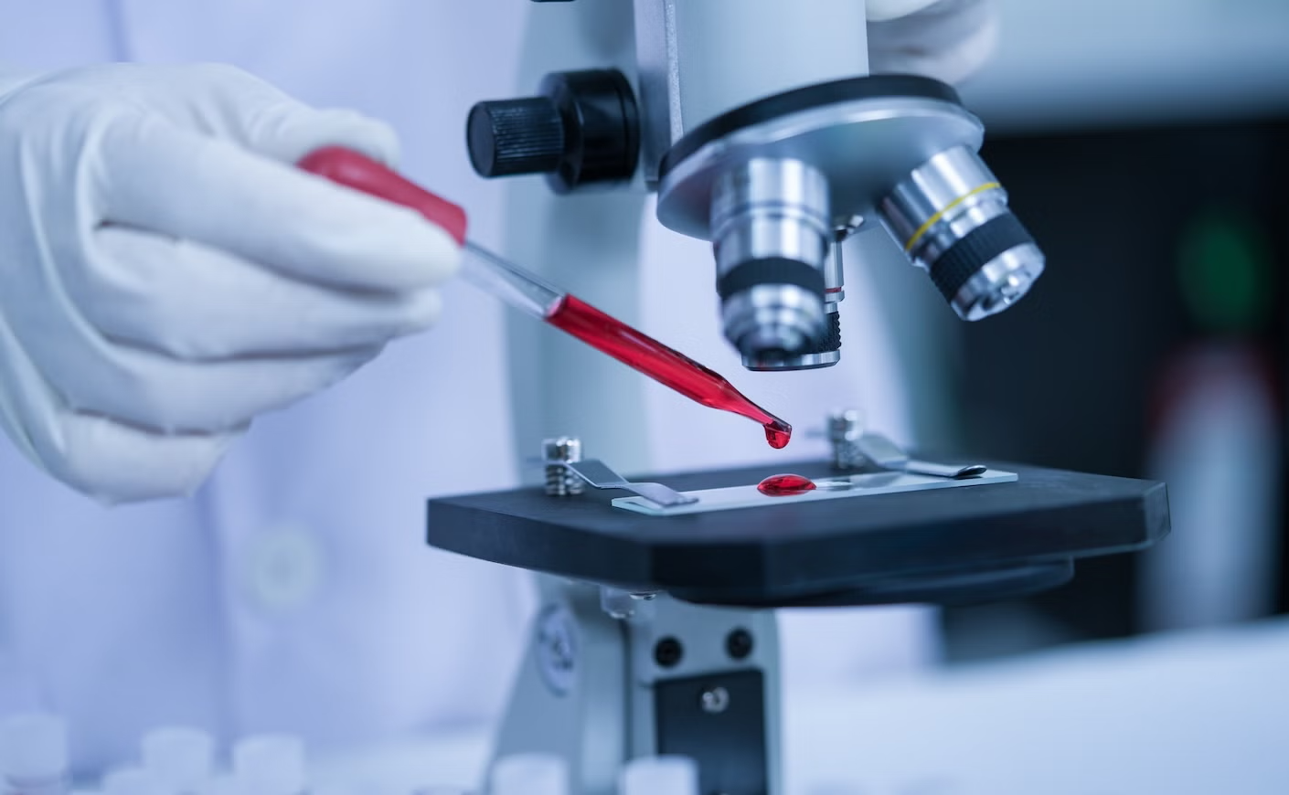 Researcher dropping a drop of red liquid with a pipette onto a microscope slide