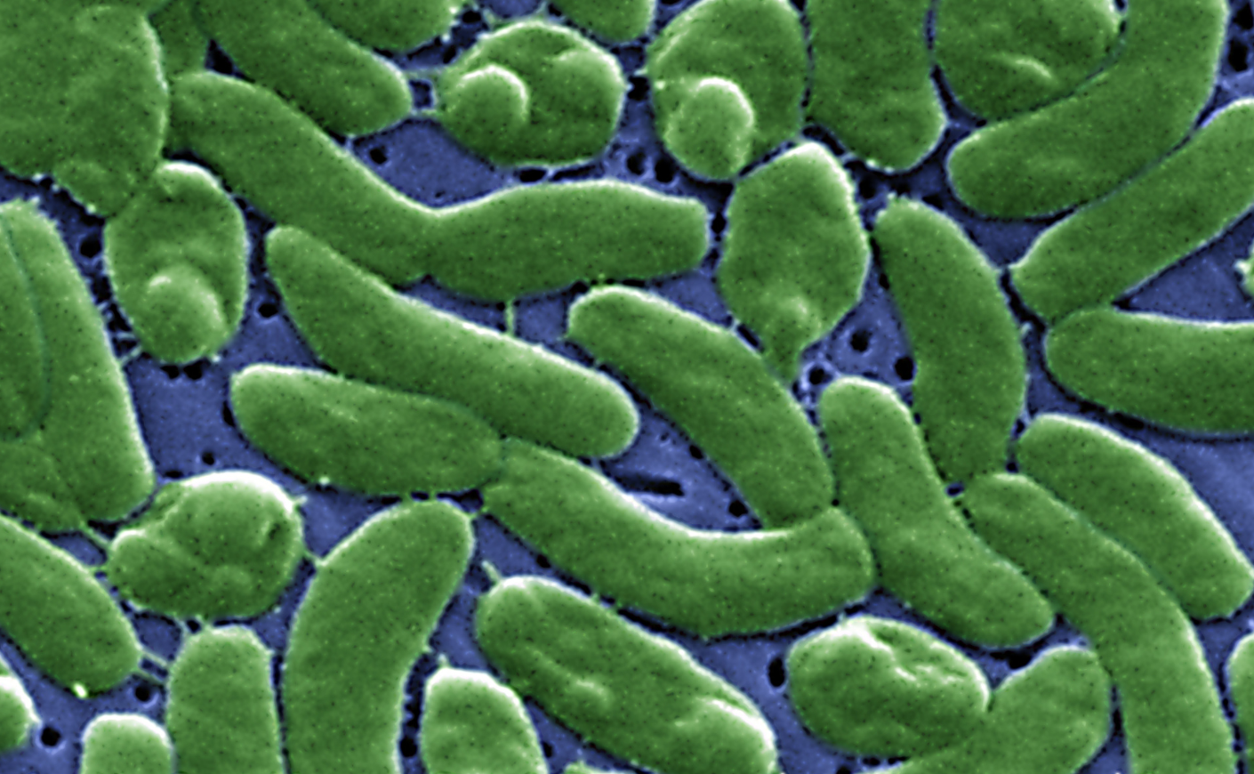A close-up of Vibrio vulnificus.
