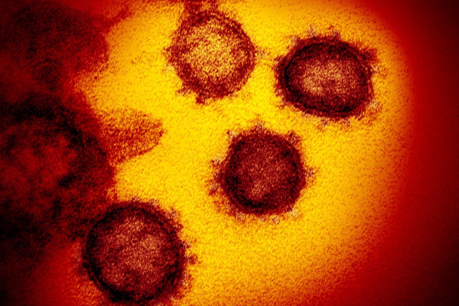 A transmission electron microscope image of SARS-CoV-2, also known as coronavirus.