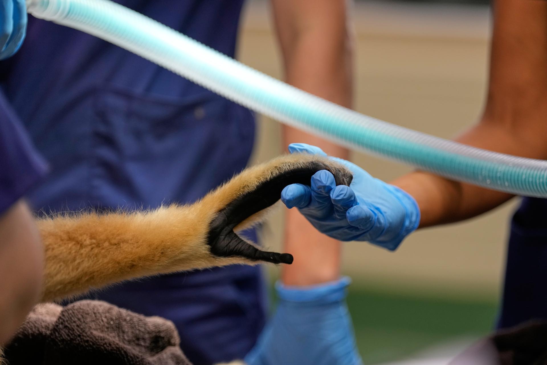 A zoo employee holds the hand of a white-cheeked gibbon during a wellness checkup at the Turtle Back Zoo in August. (AP Photo/Seth Wenig)