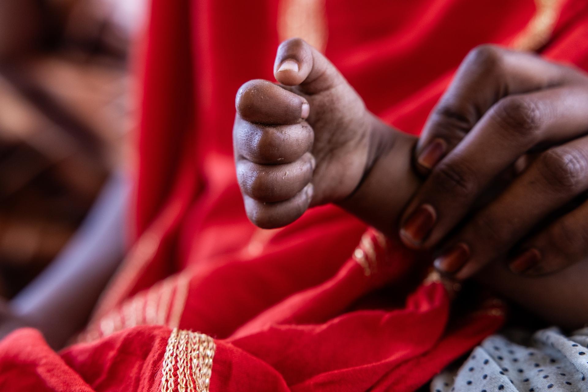 A mother holds the clenched hand of her daughter, who has not unclenched it in the eight months since fleeing mercenaries in Mali and finding refuge in Douankara, Mauritania, on Saturday. (AP Photo/Caitlin Kelly)