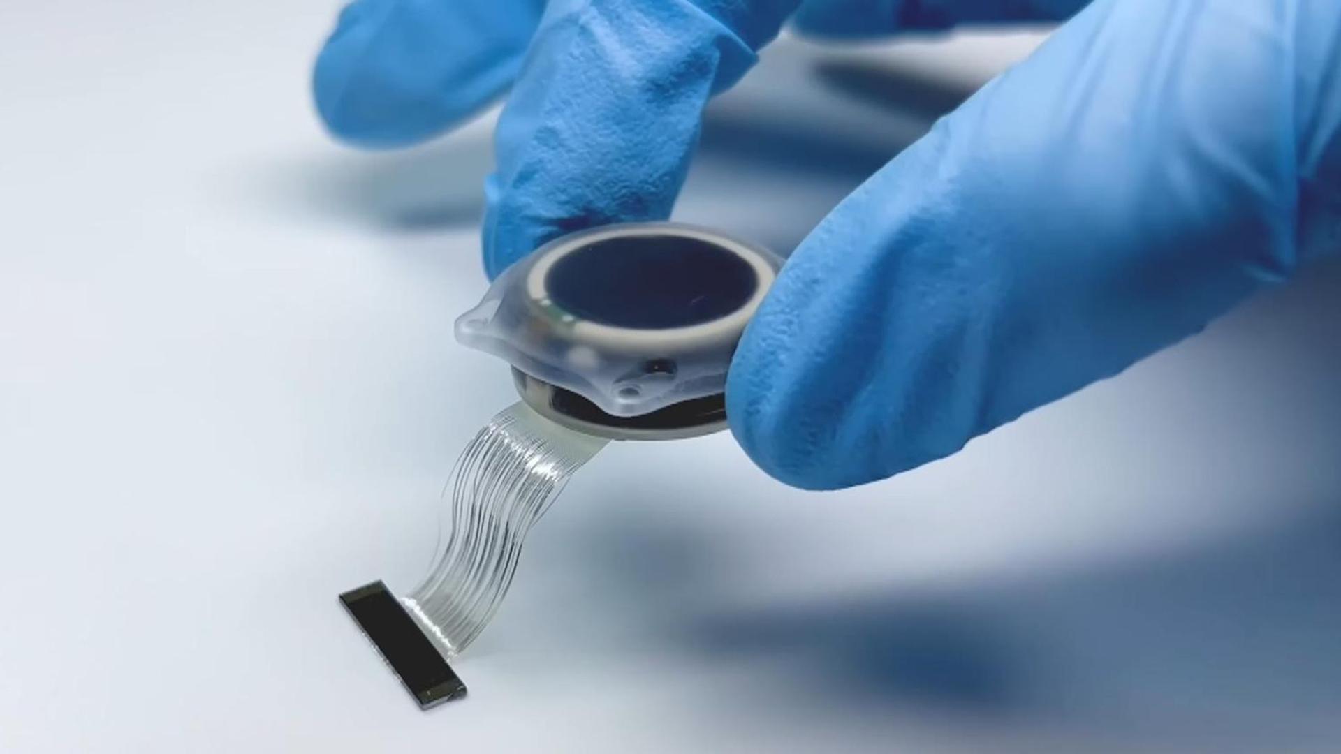 Neuralink's Chip Hits UK Hospitals